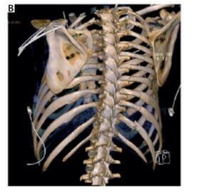 Figure from article: Regional anesthesia as an...