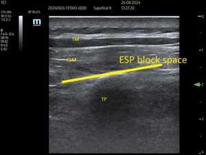 Figure from article: Effects of erector spinae...